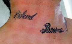 Laser Tattoo Removal Before and After Picture 1